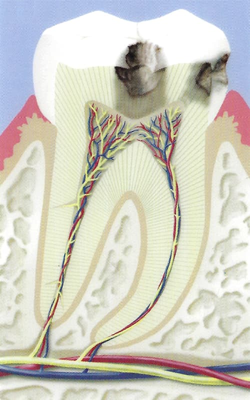 Endodontie-2